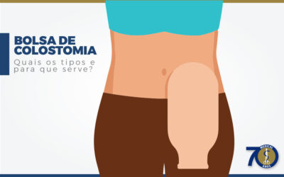 Bolsa de colostomia: quais os tipos e para que serve?